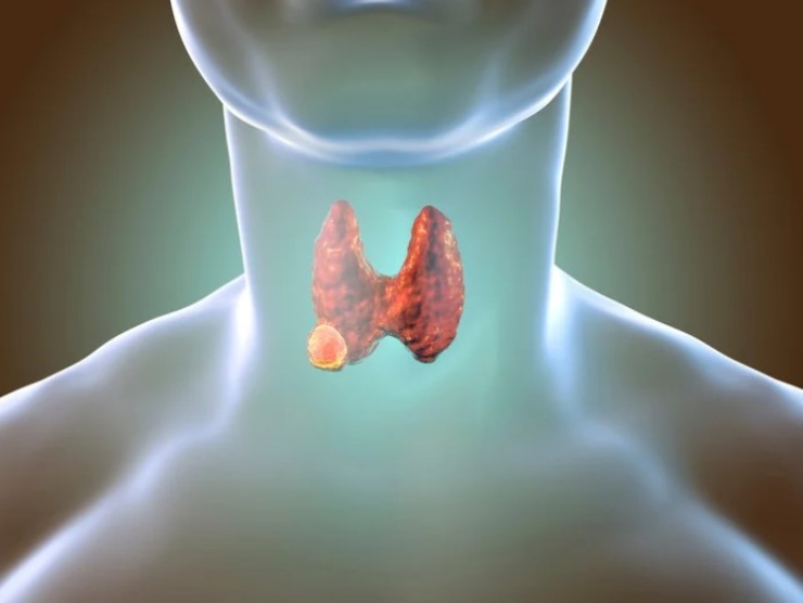 Sintomi tumore gola